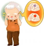 导致老年人经常头痛的原因是什么